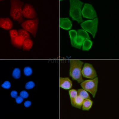 Phospho-Progesterone Receptor (Ser345) Antibody - AF8303 staining Hela cells(30min of UV treatment) by IF/ICC.