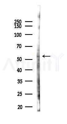 Phospho-RAD23 (Ser357) Antibody - Western blot analysis of lysates from HUVEC cells(UV,30min treatment), using Phospho-RAD23 (Ser357) Antibody at 1/1000 dilution.