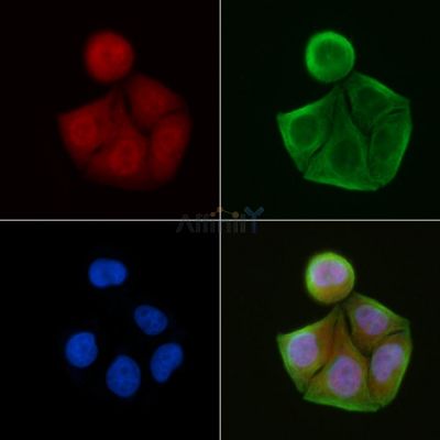 Phospho-SP1 (Thr278) Antibody - AF8317 staining Hela cells(30min of UV treatment) by IF/ICC.