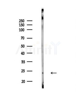 Phospho-STMN2 (Ser73) Antibody - Western blot analysis of lysates from MDA-MB-231 cells(heat-shock,45min treatment), using Phospho-STMN2 (Ser73) Antibody at 1/1000 dilution.