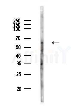 Phospho-AKT1 (Ser473) Antibody - Western blot analysis of lysates from PC12 cells, using Phospho-AKT1 (Ser473) Antibody at 1/1000 dilution.