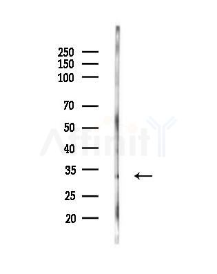 Phospho-CDK5 (Ser159) Antibody - Western blot analysis of lysates from MCF7 cells(heat-shock,45min treatment), using Phospho-CDK5 (Ser159) Antibody at 1/1000 dilution.