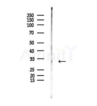 Phospho-CDK5 (Ser159) Antibody - Western blot analysis of lysates from PC12 cells, using Phospho-CDK5 (Ser159) Antibody at 1/1000 dilution.