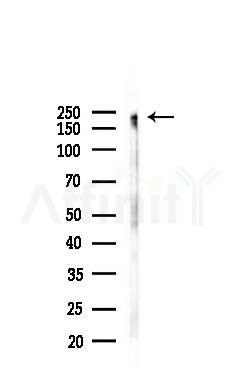 Phospho-MLCK (Tyr464) Antibody - Western blot analysis of lysates from K562 cells(heat-shock,45min treatment), using Phospho-MLCK (Tyr464) Antibody at 1/1000 dilution.