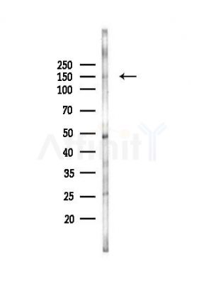 Phospho-PLCG2 (Tyr1197) Antibody - Western blot analysis of lysates from Hela cells(UV, 30min treatment), using Phospho-PLCG2 (Tyr1197) Antibody at 1/1000 dilution.