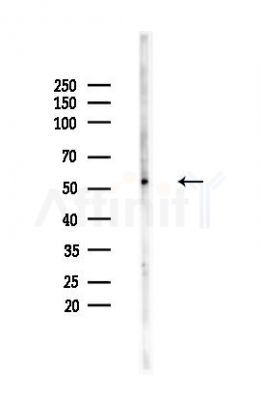Phospho-PPAR  alpha (Ser12) Antibody - Western blot analysis of lysates from HUVEC cells(heat-shock,45min treatment), using Phospho-PPAR  alpha (Ser12) Antibody at 1/1000 dilution.