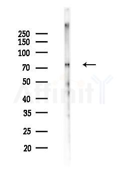 Phospho-PKC gamma (Thr655) Antibody - Western blot analysis of lysates from Mouse brain, using Phospho-PKC gamma (Thr655) Antibody at 1/1000 dilution.