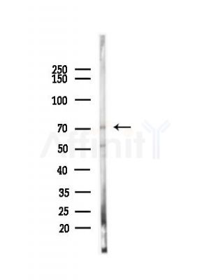 Phospho-SHC (Tyr239+Tyr240)[Tyr349+Tyr350] Antibody - Western blot analysis of lysates from EC304 cells(heat-shock,45min treatment), using Phospho-SHC (Tyr239+Tyr240)[Tyr349+Tyr350] Antibody at 1/1000 dilution.