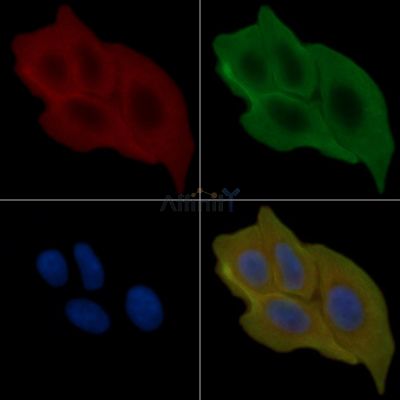Phospho-MCSF Receptor (Tyr921) Antibody - AF8418 staining Hela cells(30min of UV treatment) by IF/ICC.