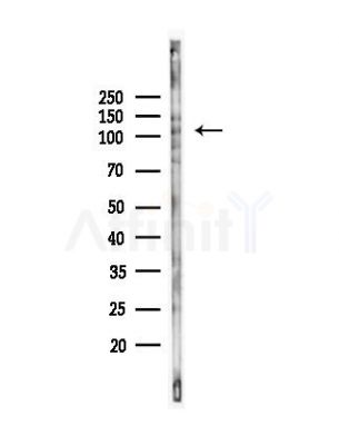 Phospho-EPHA1 (Tyr599) Antibody - Western blot analysis of lysates from Hela cells(UV, 30min treatment), using Phospho-EPHA1 (Tyr599) Antibody at 1/1000 dilution.