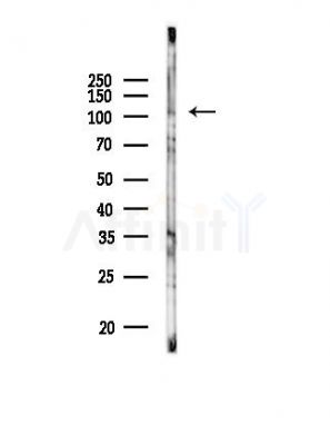 Phospho-EPHA1 (Tyr599) Antibody - Western blot analysis of lysates from HepG2 cells(starvation,24h treatment), using Phospho-EPHA1 (Tyr599) Antibody at 1/1000 dilution.