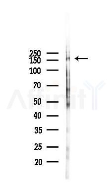 Phospho-MER/TYRO3 (Tyr753/Tyr685) Antibody - Western blot analysis of lysates from COLO205 cells(heat-shock,45min treatment), using Phospho-MER/TYRO3 (Tyr753/Tyr685) Antibody at 1/1000 dilution.