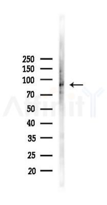 Phospho-SRPK1 (Thr601) Antibody - Western blot analysis of lysates from COLO205 cells(heat-shock,45min treatment), using Phospho-SRPK1 (Thr601) Antibody at 1/1000 dilution.