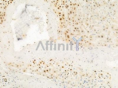 Phospho-14-3-3 sigma (Ser186) Antibody - AF8458 at 1/100 staining human normal liver tissue by IHC-P.