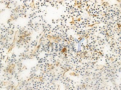 Phospho-14-3-3 sigma (Ser186) Antibody - AF8458 at 1/100 staining human pituitary adenoma by IHC-P.