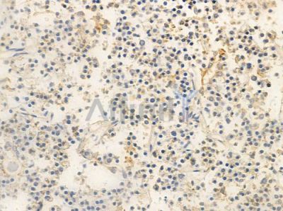 Phospho-CBX1 / HP1 beta (Thr51) Antibody - AF8483 at 1/100 staining human pituitary adenoma by IHC-P.