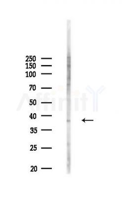 Phospho-Nucleophosmin (Thr237) Antibody - Western blot analysis of lysates from COLO205 cells(heat-shock,45min treatment), using Phospho-Nucleophosmin (Thr237) Antibody at 1/1000 dilution.