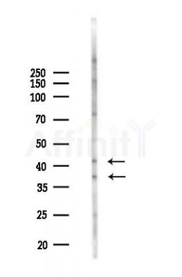 Phospho-Nucleophosmin (Thr237) Antibody - Western blot analysis of lysates from HepG2 cells(heat-shock,45min treatment), using Phospho-Nucleophosmin (Thr237) Antibody at 1/1000 dilution.