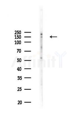 Phospho-Raptor (Ser863) Antibody - Western blot analysis of lysates from COLO205 cells(heat-shock,45min treatment), using Phospho-Raptor (Ser863) Antibody at 1/1000 dilution.