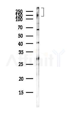 CD227/MUC1 Antibody - Western blot analysis of lysates from COLO205 cells(heat-shock,45min treatment), using CD227/MUC1 Antibody at 1/1000 dilution.