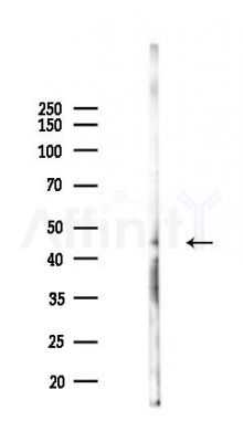 Phospho-PGK1 (Tyr324) Antibody - Western blot analysis of lysates from HUVEC cells(UV,30min treatment), using Phospho-PGK1 (Tyr324) Antibody at 1/1000 dilution.