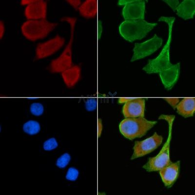 Adenylate cyclase 1 Antibody - AF9001 staining Hela cells(30min of UV treatment) by IF/ICC.