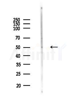 ARHGAP1 Antibody - Western blot analysis of lysates from MCF7 cells(heat-shock,45min treatment), using ARHGAP1 Antibody at 1/1000 dilution.