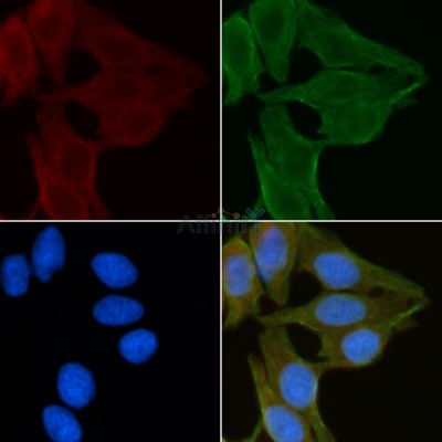 Arrdc1 Antibody - AF9016 staining Hela cells(30min of UV treatment) by IF/ICC.