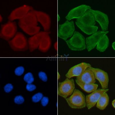 Arrdc4 Antibody - AF9018 staining Hela cells(30min of UV treatment) by IF/ICC.