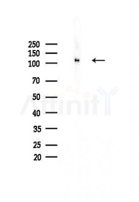 CAS Antibody - Western blot analysis of lysates from HUVEC cells(heat-shock,45min treatment), using CAS Antibody at 1/1000 dilution.