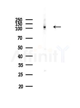 CAS Antibody - Western blot analysis of lysates from MCF7 cells(heat-shock,45min treatment), using CAS Antibody at 1/1000 dilution.