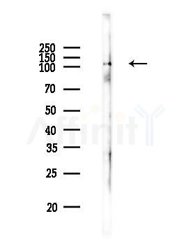 CAS Antibody - Western blot analysis of lysates from PC12 cells, using CAS Antibody at 1/1000 dilution.