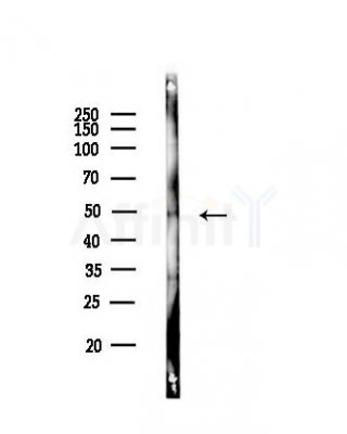 Casein Kinase Igamma1 Antibody - Western blot analysis of lysates from HUVEC cells(heat-shock,42min treatment), using Casein Kinase Igamma1 Antibody at 1/1000 dilution.