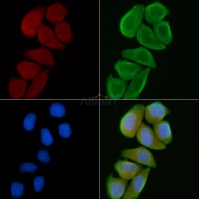 Casein Kinase Igamma1 Antibody - AF9033 staining Hela cells(30min of UV treatment) by IF/ICC.