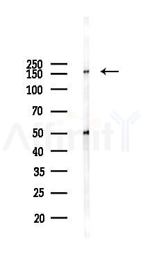 DEF-3 Antibody - Western blot analysis of lysates from 293 cells(UV,30min treatment), using DEF-3 Antibody at 1/1000 dilution.