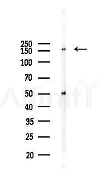 DEF-3 Antibody - Western blot analysis of lysates from 293 cells(UV,30min treatment), using DEF-3 Antibody at 1/1000 dilution.