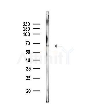 Eps8L3 Antibody - Western blot analysis of lysates from Rat muscle, using Eps8L3 Antibody at 1/1000 dilution.