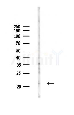 Granzyme H Antibody - Western blot analysis of lysates from Rat liver, using Granzyme H Antibody at 1/1000 dilution.