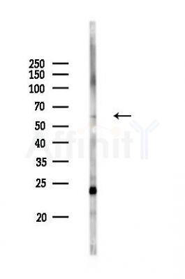 HABP2 Antibody - Western blot analysis of lysates from Rat liver, using HABP2 Antibody at 1/1000 dilution.