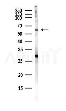 IFIT1 Antibody - Western blot analysis of lysates from COLO205 cells(heat-shock,45min treatment), using IFIT1 Antibody at 1/1000 dilution.