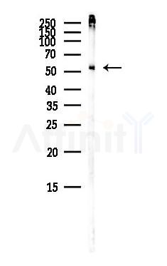 IFIT1 Antibody - Western blot analysis of lysates from Mouse brain, using IFIT1 Antibody at 1/1000 dilution.