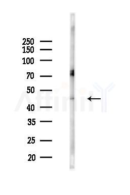 IL13 receptor alpha 1 Antibody - Western blot analysis of lysates from Mouse brain, using IL13 receptor alpha 1 Antibody at 1/1000 dilution.