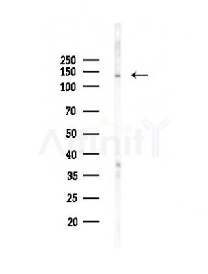 INTS2 Antibody - Western blot analysis of lysates from PC12 cells(UV,30min treatment), using INTS2 Antibody at 1/1000 dilution.