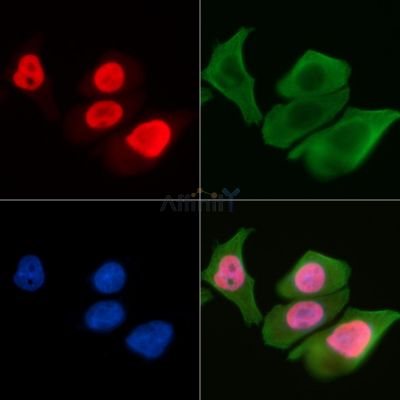 INTS2 Antibody - AF9098 staining Hela cells(30min of UV treatment) by IF/ICC.