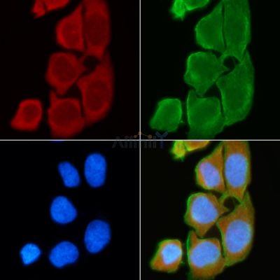 GIRK1/KIR3.1/KCNJ3 Antibody - AF9101 staining Hela cells(30min of UV treatment) by IF/ICC.