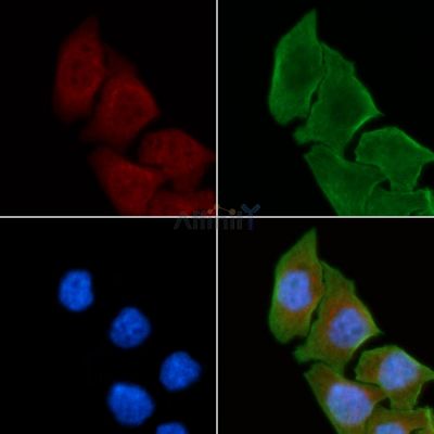 ME2 Antibody - AF9111 staining Hela cells(30min of UV treatment) by IF/ICC.