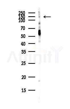 MINK1 Antibody - Western blot analysis of lysates from COLO205 cells(heat-shock,45min treatment), using MINK1 Antibody at 1/1000 dilution.