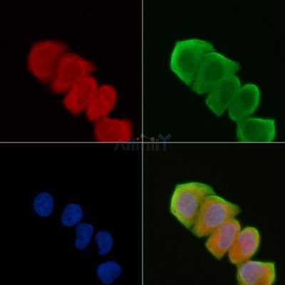 MRCKbeta Antibody - AF9116 staining Hela cells(30min of UV treatment) by IF/ICC.