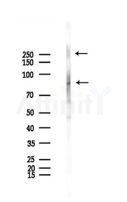 CD171/N-CAML1 Antibody - Western blot analysis of lysates from Mouse testis, using CD171/N-CAML1 Antibody at 1/1000 dilution.