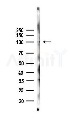 Nek9 Antibody - Western blot analysis of lysates from Rat liver, using Nek9 Antibody at 1/1000 dilution.
